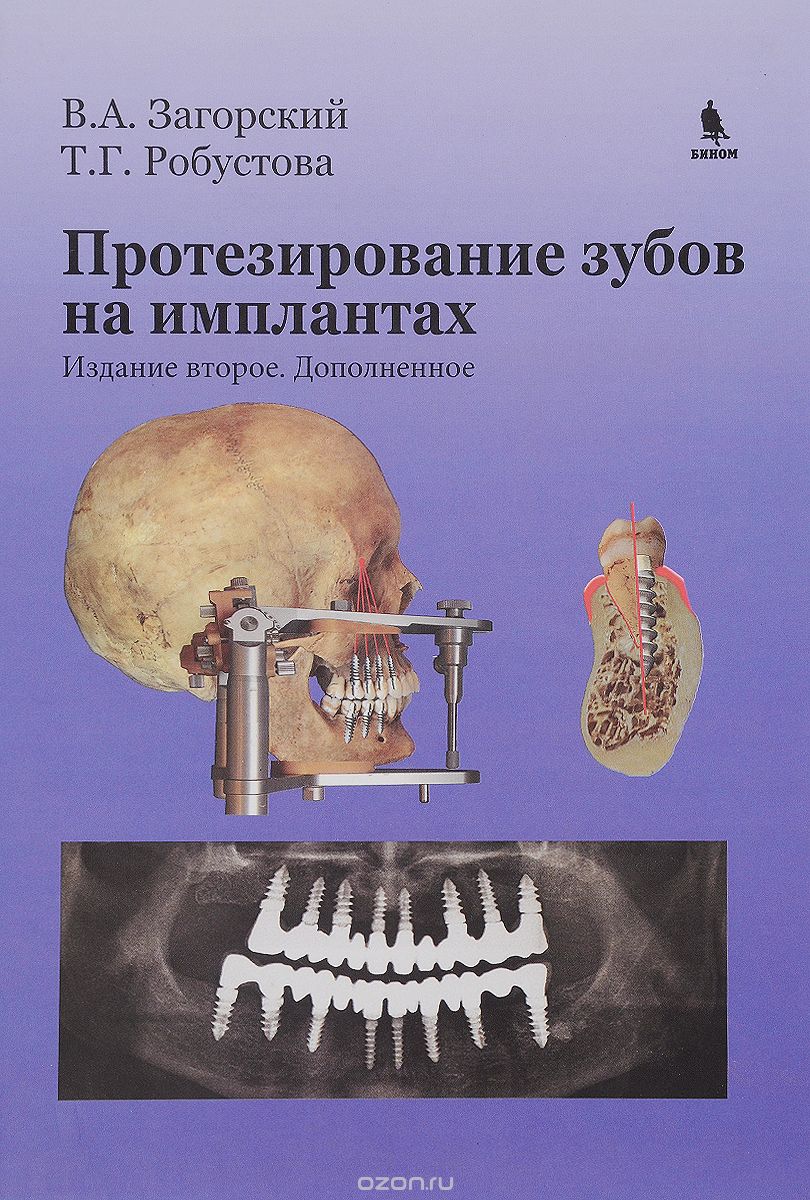 Скачать книгу "Протезирование зубов на имплантах, В. А. Загорский, Т. Г. Робустова"
