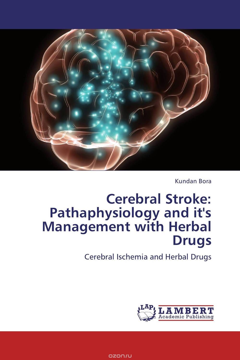 Скачать книгу "Cerebral Stroke: Pathaphysiology and it's Management with Herbal Drugs"